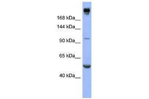 WB Suggested Anti-INSR Antibody Titration:  0. (Insulin Receptor Antikörper  (Middle Region))