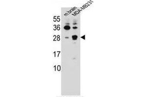 CBLN2 Antibody (C-term) western blot analysis in mouse brain tissue and MDA-MB231 cell line lysates (35ug/lane). (CBLN2 Antikörper  (C-Term))