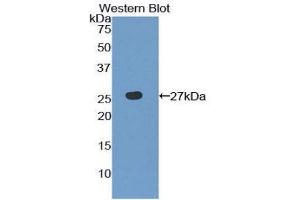 Western Blotting (WB) image for anti-Toll-Like Receptor 6 (TLR6) (AA 608-796) antibody (ABIN1860775)