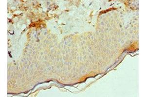 Immunohistochemistry of paraffin-embedded human skin tissue using ABIN7143181 at dilution of 1:100