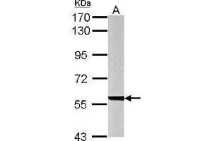 Western Blotting (WB) image for anti-UDP-Glucose 6-Dehydrogenase (UGDH) antibody (ABIN2856009)