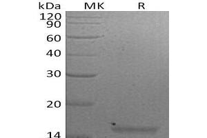 Western Blotting (WB) image for Interleukin 21 (IL21) protein (ABIN7320585) (IL-21 Protein)