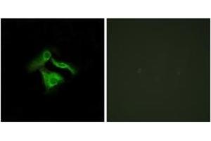 Immunofluorescence analysis of HeLa cells, using GPR149 Antibody. (GPR149 Antikörper  (AA 451-500))
