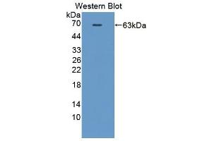 Western blot analysis of the recombinant protein. (HCK Antikörper  (AA 2-524))