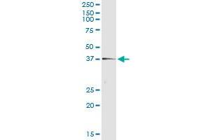 Immunoprecipitation of TEX264 transfected lysate using anti-TEX264 monoclonal antibody and Protein A Magnetic Bead , and immunoblotted with TEX264 MaxPab rabbit polyclonal antibody. (TEX264 Antikörper  (AA 1-313))