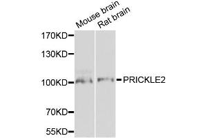 Western blot analysis of extracts of various cell lines, using PRICKLE2 antibody. (PRICKLE2 Antikörper)