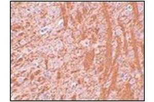 Immunohistochemistry of JMJD6 in rat brain tissue with this product at 2. (JMJD6 Antikörper  (N-Term))