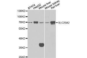 Western blot analysis of extracts of various cell lines, using SLC20A2 antibody (ABIN5974076) at 1/1000 dilution. (SLC20A2 Antikörper)
