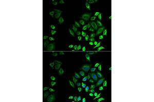 Immunofluorescence analysis of U2OS cells using PLA2G2D antibody.