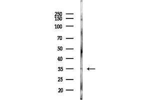 anti-Sine Oculis-Related Homeobox 3 (SIX3) (C-Term) antibody