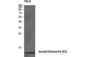 Western Blot (WB) analysis of specific cells using Acetyl-Histone H4 (K5) Polyclonal Antibody.