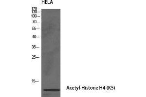 Western Blot (WB) analysis of specific cells using Acetyl-Histone H4 (K5) Polyclonal Antibody. (Histone H4 Antikörper  (acLys5))