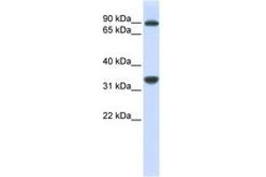 Image no. 1 for anti-Ribosomal RNA Processing 1 Homolog B (RRP1B) (AA 684-733) antibody (ABIN6740938) (RRP1B Antikörper  (AA 684-733))