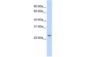 WB Suggested Anti-RAB8A Antibody Titration:  0.