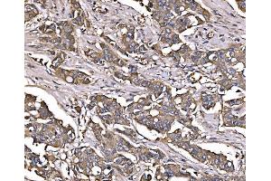 IHC analysis of LSR using anti-LSR antibody (ABIN7599514). (LSR Antikörper  (AA 1-649))