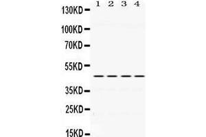 Western Blotting (WB) image for anti-Paired Box 6 (PAX6) (AA 195-233), (Middle Region) antibody (ABIN3043379) (PAX6 Antikörper  (Middle Region))