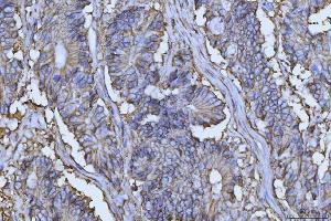 IHC analysis of CD147/Emmprin using anti-CD147/Emmprin antibody (ABIN7599999). (CD147 Antikörper  (AA 138-323))