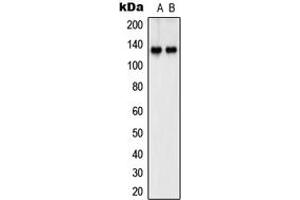 Western blot analysis of SHANK2 expression in Jurkat (A), IMR32 (B) whole cell lysates. (SHANK2 Antikörper  (Center))