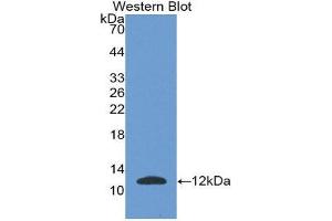 Western Blotting (WB) image for anti-Estrogen Receptor 2 (ESR2) (AA 149-213) antibody (ABIN1078003) (ESR2 Antikörper  (AA 149-213))