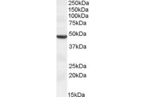Western Blotting (WB) image for anti-Transmembrane Protease, serine 4 (TMPRSS4) (Internal Region) antibody (ABIN2464170) (TMPRSS4 Antikörper  (Internal Region))