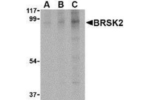 Western blot analysis of BRSK2 in human brain tissue lysate with AP30168PU-N BRSK2 antibody at (A) 0. (BRSK2 Antikörper  (C-Term))