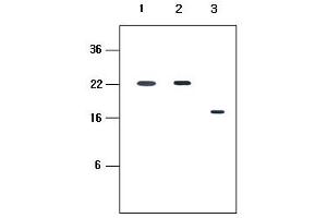 Western blot analysis: Human recombinant protein KIR2DL1, KIR2DL3 and KIR2DL4 (each 20ng per well) were resolved by SDS-PAGE, transferred to PVDF membrane and probed with anti-human KIR2DL4 (1:500). (KIR2D Antikörper)