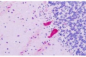 Human, Brain, Cerebellum: Formalin-Fixed Paraffin-Embedded (FFPE) (NR1I3 Antikörper  (AA 71-120))