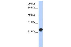 CAPS antibody used at 1 ug/ml to detect target protein. (Calcyphosine Antikörper  (N-Term))