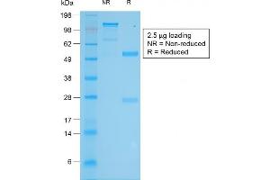SDS-PAGE Analysis Purified Tyrosinase Rabbit Recombinant Monoclonal Antibody (TYR/2024R).