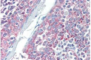 Human Tonsil (formalin-fixed, paraffin-embedded) stained with DIABLO antibody ABIN462354 followed by biotinylated anti-mouse IgG secondary antibody ABIN481714, alkaline phosphatase-streptavidin and chromogen. (DIABLO Antikörper)