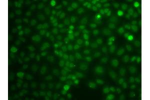 Immunofluorescence analysis of A549 cells using CBLC antibody (ABIN5975726). (CBLC Antikörper)