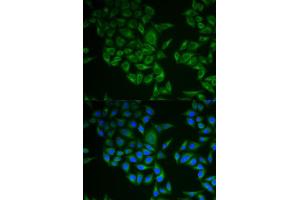 Immunofluorescence analysis of A549 cell using CD247 antibody. (CD247 Antikörper  (AA 50-164))