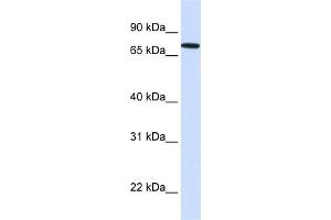 WB Suggested Anti-SETDB2 Antibody Titration:  0. (SETDB2 Antikörper  (N-Term))