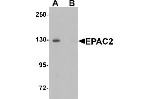 Western blot analysis of EPAC2 in rat liver tissue lysate with EPAC2 antibody at 1 µg/mL in (A) the absence and (B) the presence of blocking peptide. (RAPGEF4 Antikörper  (N-Term))