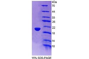 SDS-PAGE (SDS) image for Tripartite Motif Containing 3 (TRIM3) (AA 2-152) protein (His tag) (ABIN4989078) (TRIM3 Protein (AA 2-152) (His tag))
