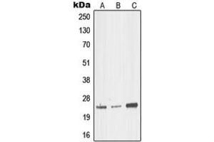 Western blot analysis of MED18 expression in HEK293T (A), mouse brain (B), rat kidney (C) whole cell lysates. (MED18 Antikörper  (Center))