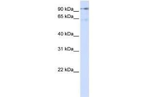 WB Suggested Anti-DLG7 Antibody Titration:  0. (DLGAP5 Antikörper  (N-Term))