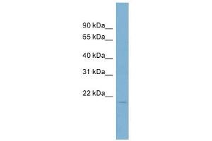 Coactosin-Like 1 antibody used at 1 ug/ml to detect target protein. (COTL1 Antikörper)