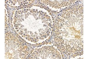 ABIN6256903 and ABIN6275795 at 1/100 staining rat testis tissue by IHC-P. (ANAPC5 Antikörper  (Internal Region))