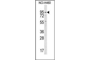 Image no. 1 for anti-Guanylate Cyclase 1, Soluble, alpha 2 (GUCY1A2) (C-Term) antibody (ABIN360707)