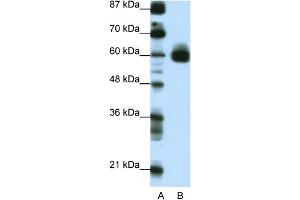 WB Suggested Anti-CIR Antibody Titration:  0. (KCNJ5 Antikörper  (C-Term))