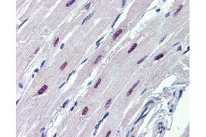 SOX4 antibody was used for immunohistochemistry at a concentration of 4-8 ug/ml. (SOX4 Antikörper  (N-Term))