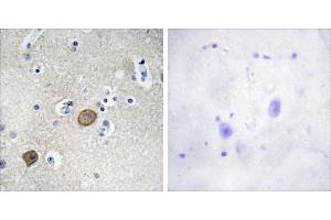 Peptide - +Immunohistochemistry analysis of paraffin-embedded human brain tissue using Catenin-α1 antibody. (CTNNA1 Antikörper  (Internal Region))