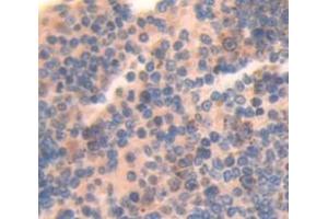 Figure. (CRLF1 Antikörper  (AA 138-422))