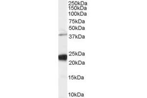 Western Blotting (WB) image for anti-GIPC PDZ Domain Containing Family, Member 1 (GIPC1) (C-Term) antibody (ABIN2465223) (GIPC1 Antikörper  (C-Term))