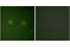 Immunofluorescence analysis of HeLa cells, using PPAR-alpha (Ab-21) Antibody. (PPARA Antikörper  (AA 6-55))
