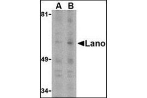 Western blot analysis of Lano in PC-3 whole cell lysate with this product at (A) 1 or (B) 2 μg /ml. (LRRC1 Antikörper  (C-Term))