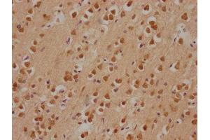 IHC image of ABIN7146598 diluted at 1:200 and staining in paraffin-embedded human brain tissue performed on a Leica BondTM system. (PRKACA Antikörper  (Catalytic Subunit alpha))