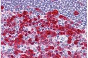 Human Tonsil: Formalin-Fixed, Paraffin-Embedded (FFPE) (Deoxyuridine Triphosphatase (DUT) (AA 68-164) Antikörper)