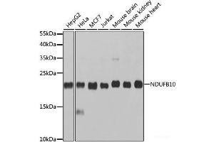 Western blot analysis of extracts of various cell lines using NDUFB10 Polyclonal Antibody at dilution of 1:1000. (NDUFB10 Antikörper)